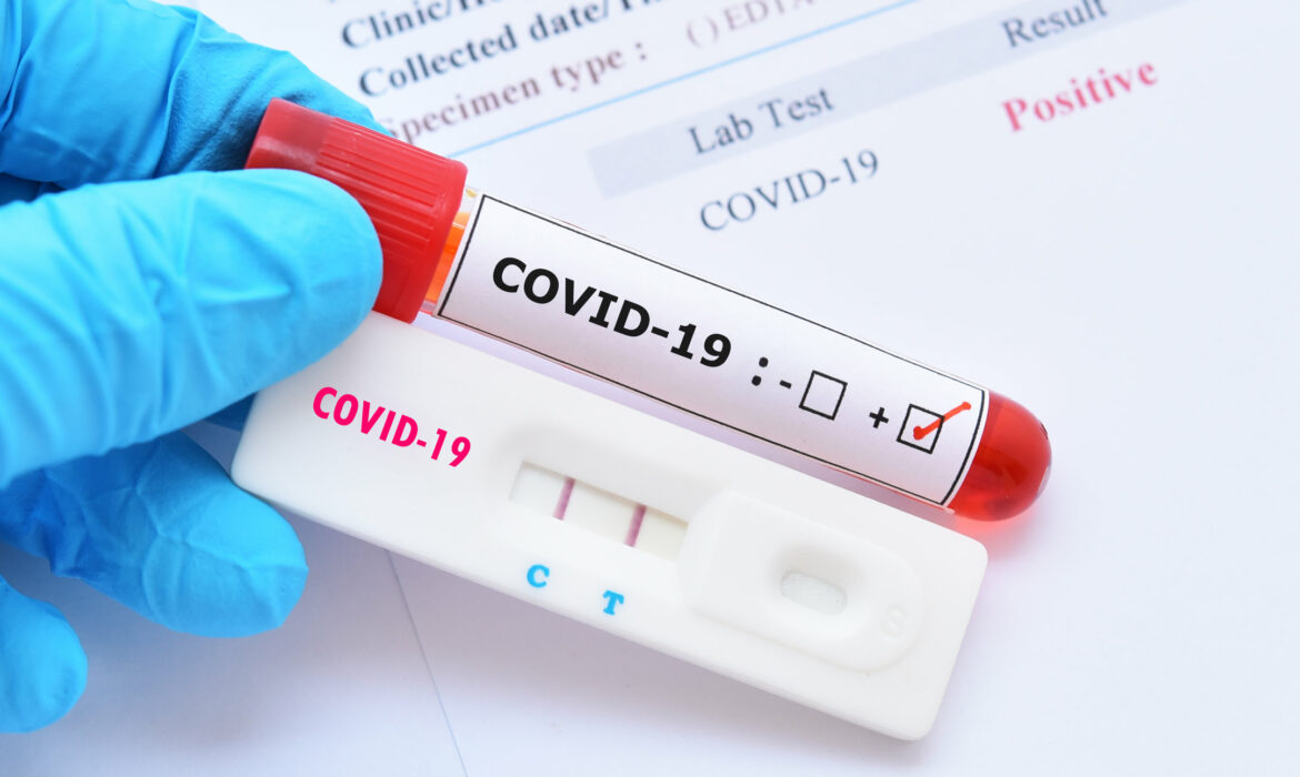 Positive,Test,Result,By,Using,Rapid,Test,Device,For,Covid-19