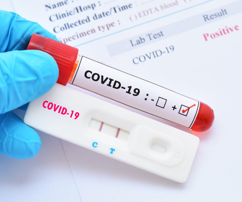 Positive,Test,Result,By,Using,Rapid,Test,Device,For,Covid-19